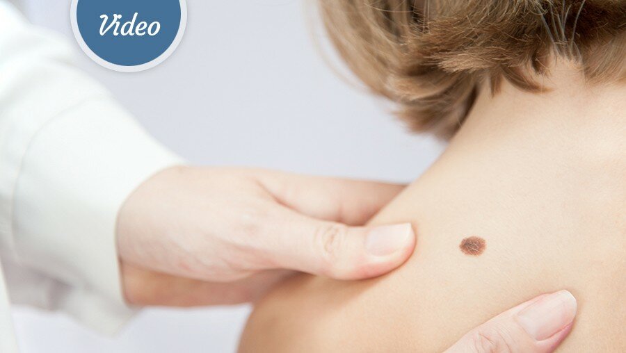 Why do some people have birthmarks?